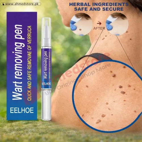 Wart Removing Pen