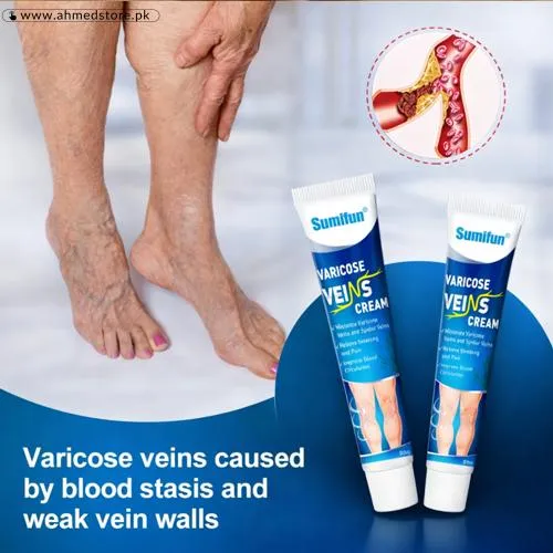 Varicose Veins Cream in Pakistan